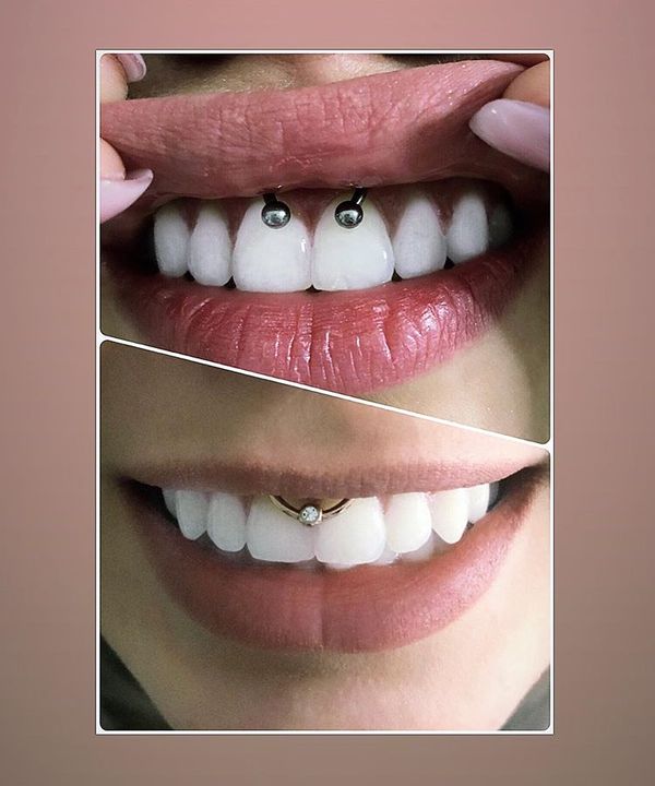 smiley piercing pain